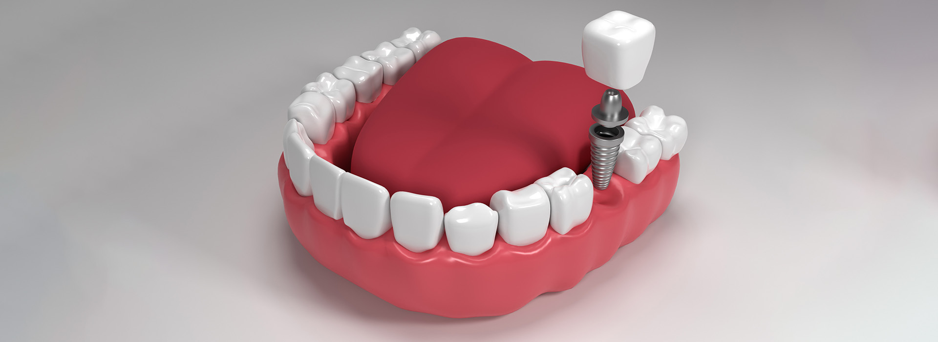 Dental Services in Kothapet